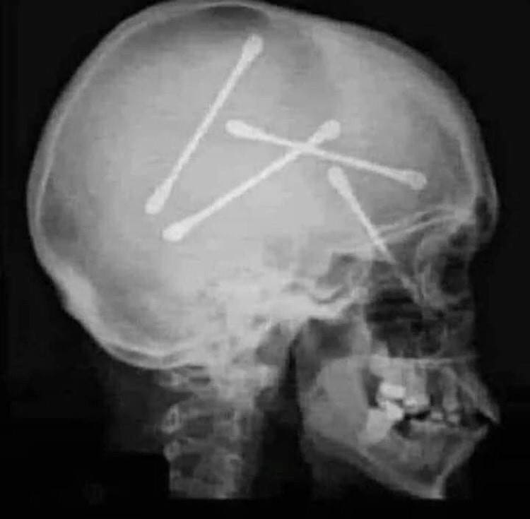 Radiographie d'un habitué des tests PCR