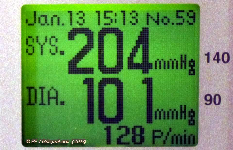 Tension : 20,4 / 10,1 - Pouls : 128 pulsations par minute Écran de tensiomètre après mesure le 13/01/2016 à 15:13