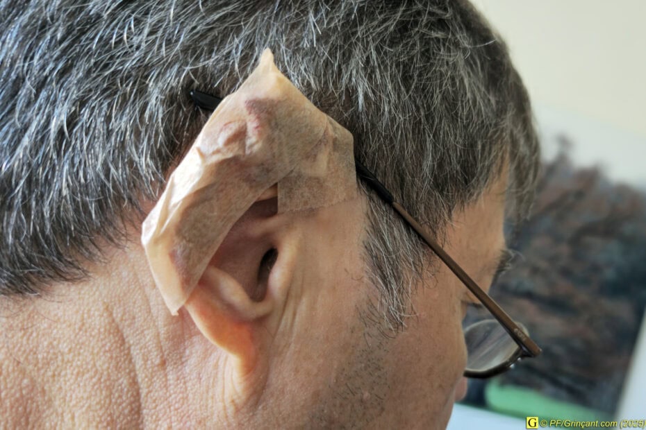 Pansement sur mesure pour lobe d'oreille (humaines)