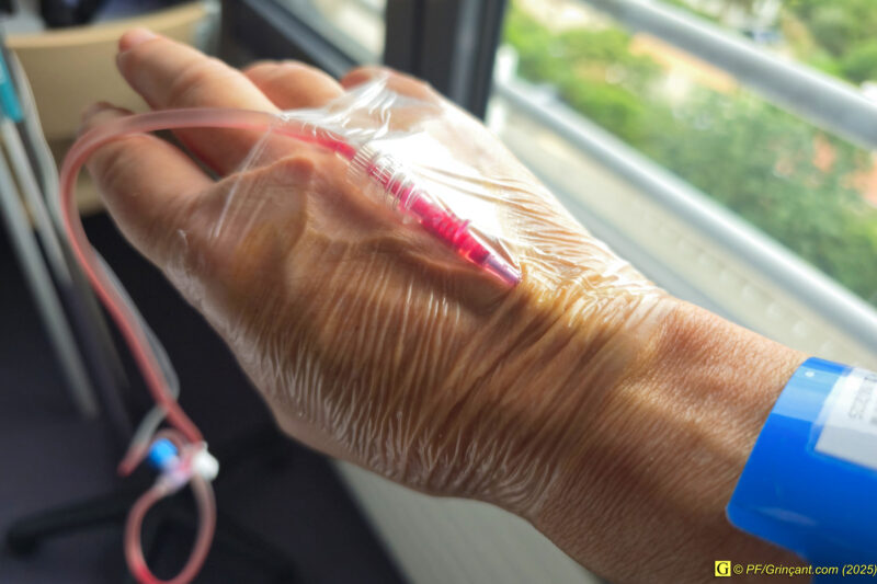 Cathéter/perfusion sur le dos de la main droite Cathéter/perfusion sur le dos de la main droite